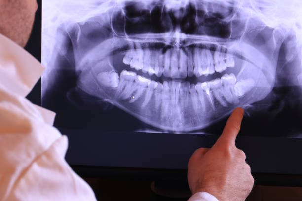 Best Pediatric Emergency Dentist in Berthoud, CO